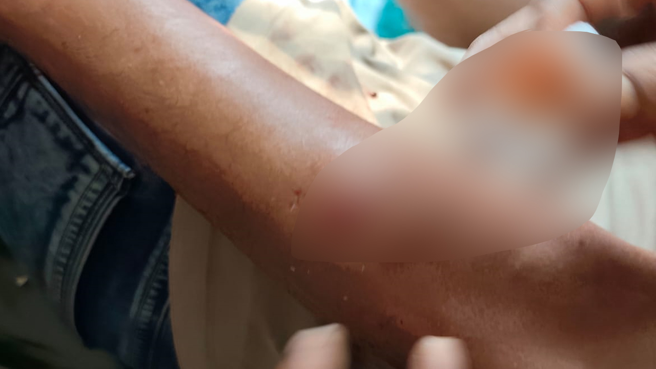 ফরিদপুরে যাত্রীবাহী বাস খাদে পড়ে ১৭ জন আহত