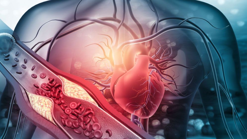 কোলেস্টেরল নিয়ন্ত্রণে খাদ্যাভ্যাসের গুরুত্ব