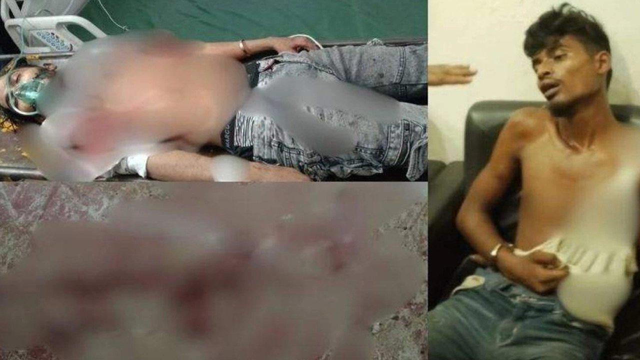 শহীদ মিনারে গুলিবিদ্ধ কন্টেন্ট ক্রিয়েটর রাকিবের মৃত্যু