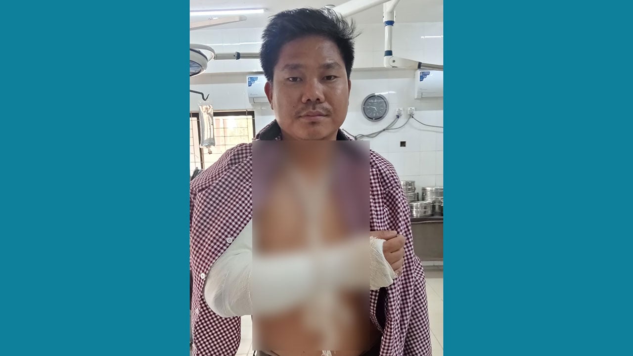 অকটেন না পেয়ে ট্যাগ অফিসারের হাত ভেঙে দিলেন কয়েকজন যুবক