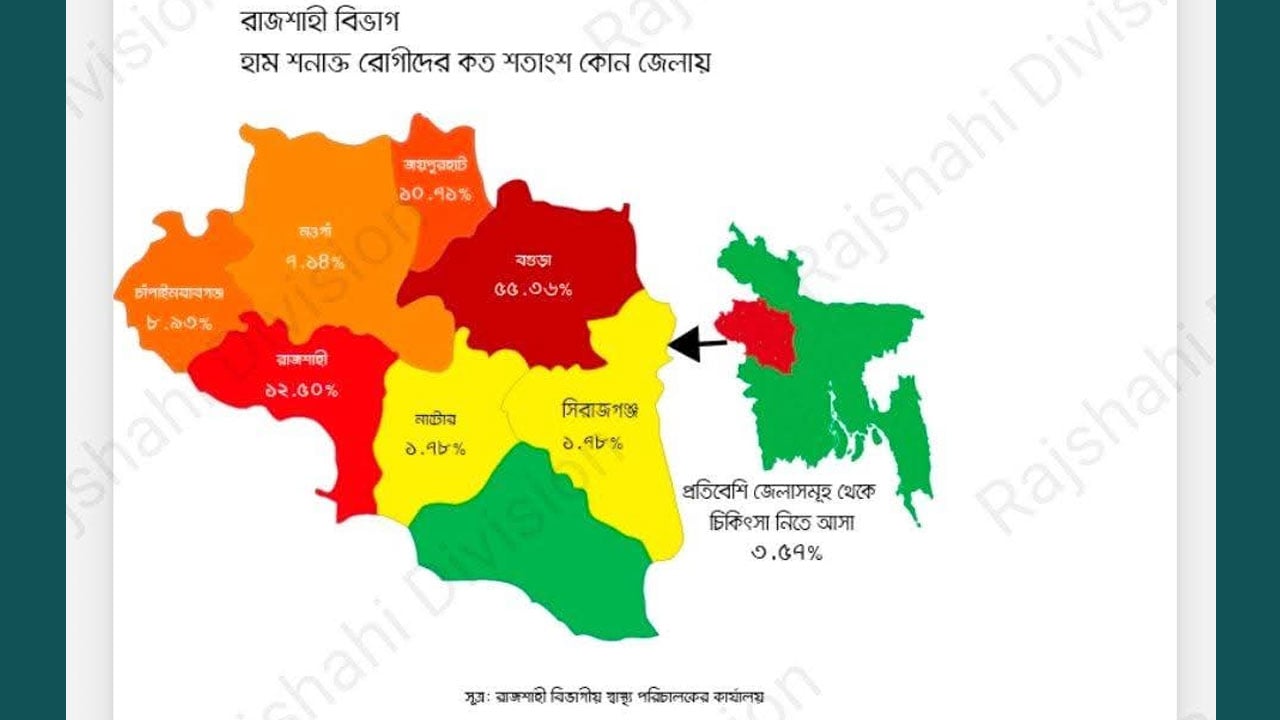 রাজশাহী বিভাগে হাম রোগের প্রাদুর্ভাব উদ্বেগজনক