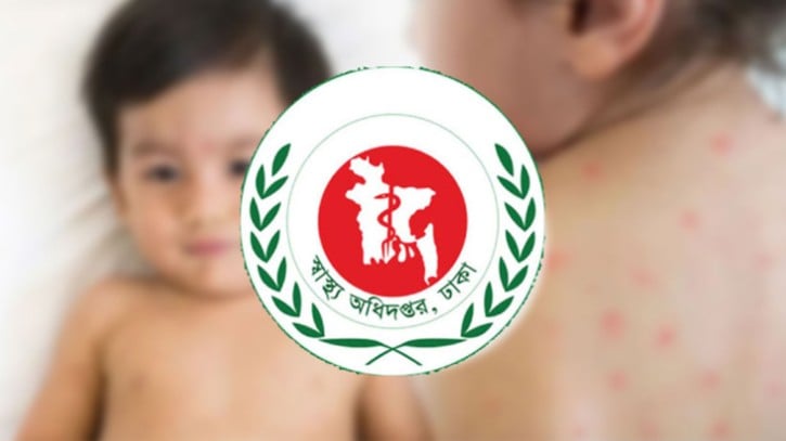 হাম ও উপসর্গে ২৪ ঘণ্টায় ৭ শিশুর মৃত্যু