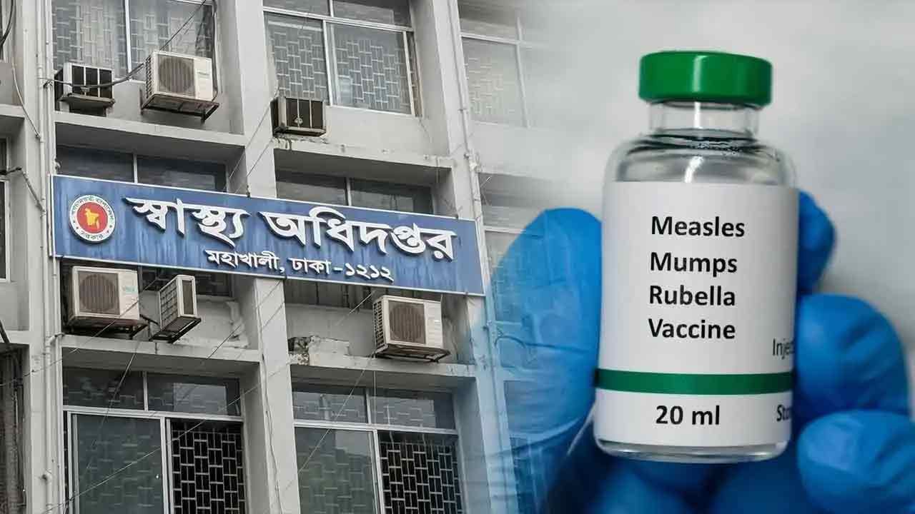 হামে আরও ৭ শিশুর মৃত্যু, নতুন আক্রান্ত ৮৮৭